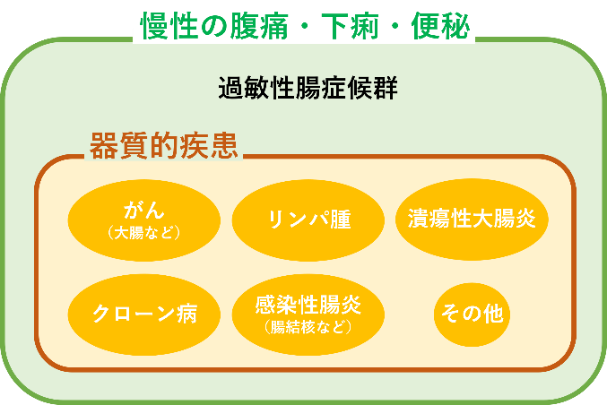 過敏性腸症候群の診断